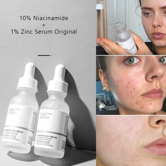 The Ordinary Niacinamide.